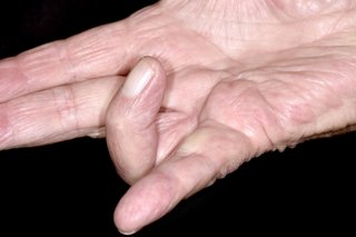 Бялата дясна ръка се подава плоска с безименен пръст, сгънат към дланта