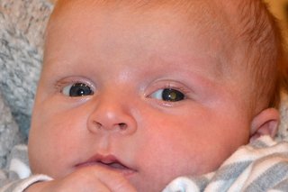 Близък план на бебешкото лице, показващ характерното бяло отражение в зеницата на окото