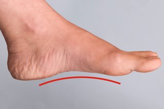 Ляв крак на жена с повдигната област (арка), видима по дъното на крака