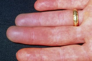 Червени пръсти, причинени от Рейно