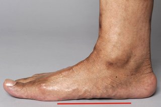 Дясният крак на мъжа е поставен на земята. Няма пролука между стъпалото и земята.