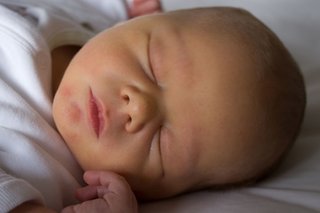 Снимка на новородено бебе с жълта кожа.